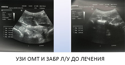 До лечения